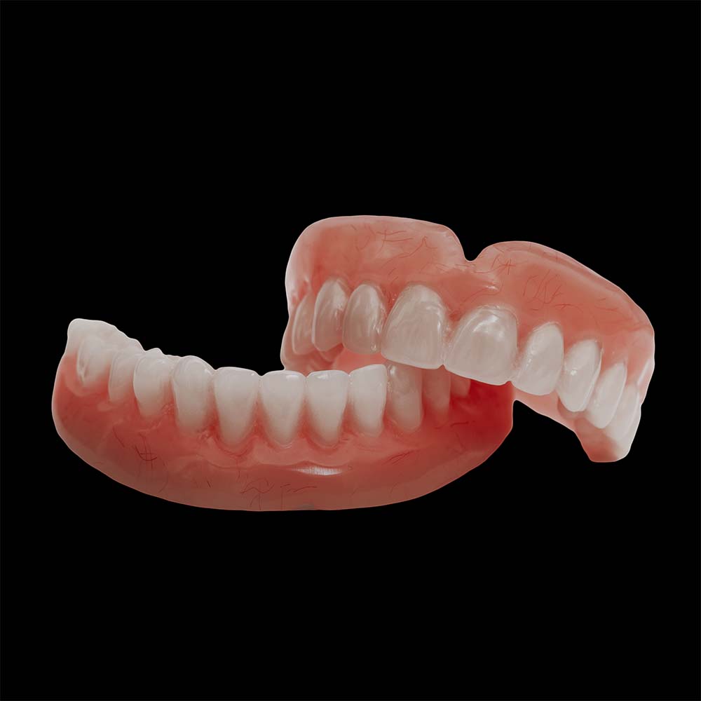dentadura metaloacrilica dentadura metaloacrilica