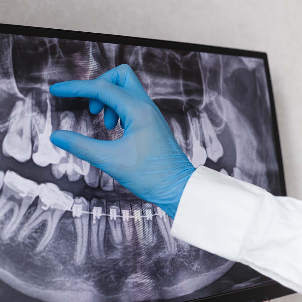 endodontia