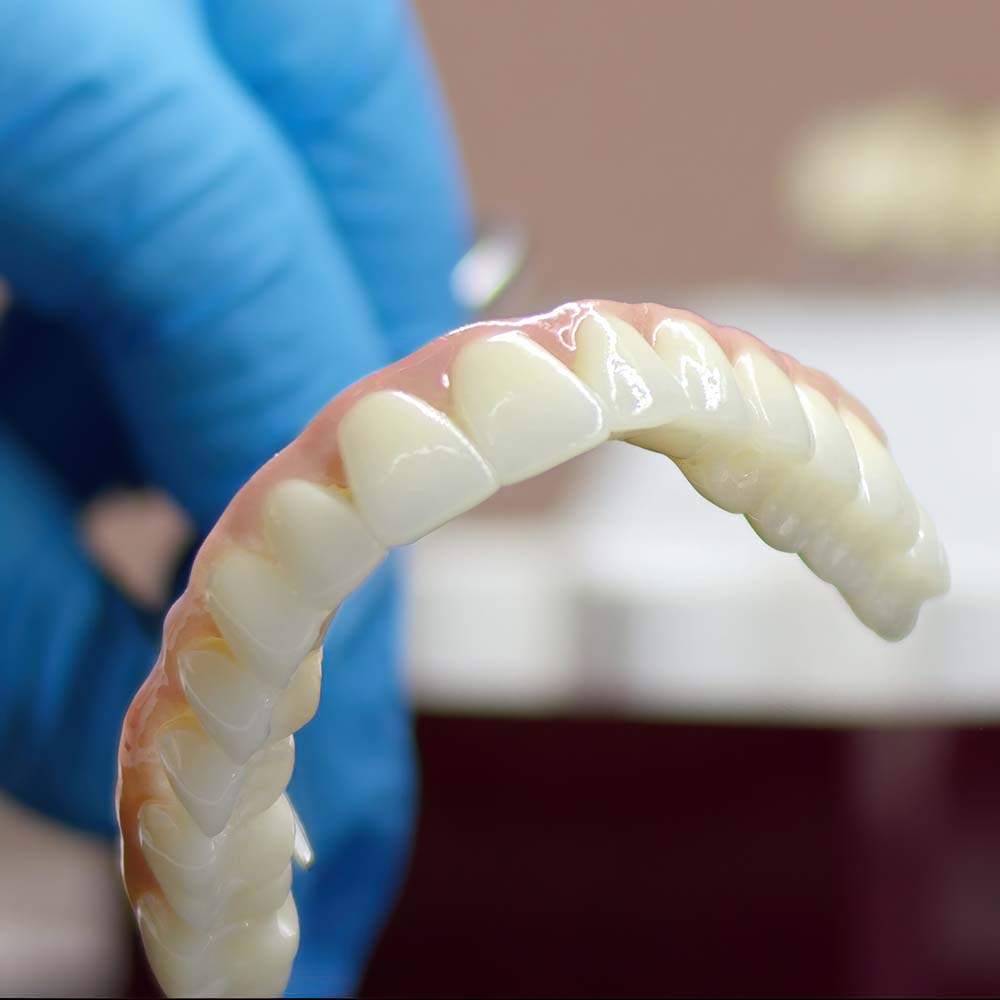 protese zirconioo ceramica protese zirconioo ceramica