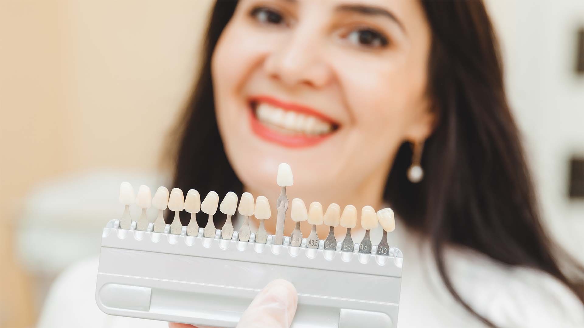 branqueamento dentário em consultório vs moldeiras. segurança, expectativas e custos