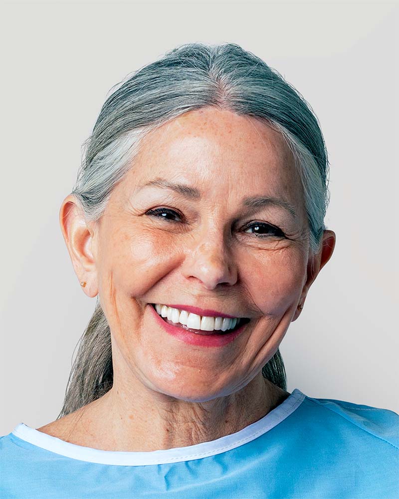 carga imediata all on 4 dentes em 1 dia carga imediata all on 4 dentes em 1 dia