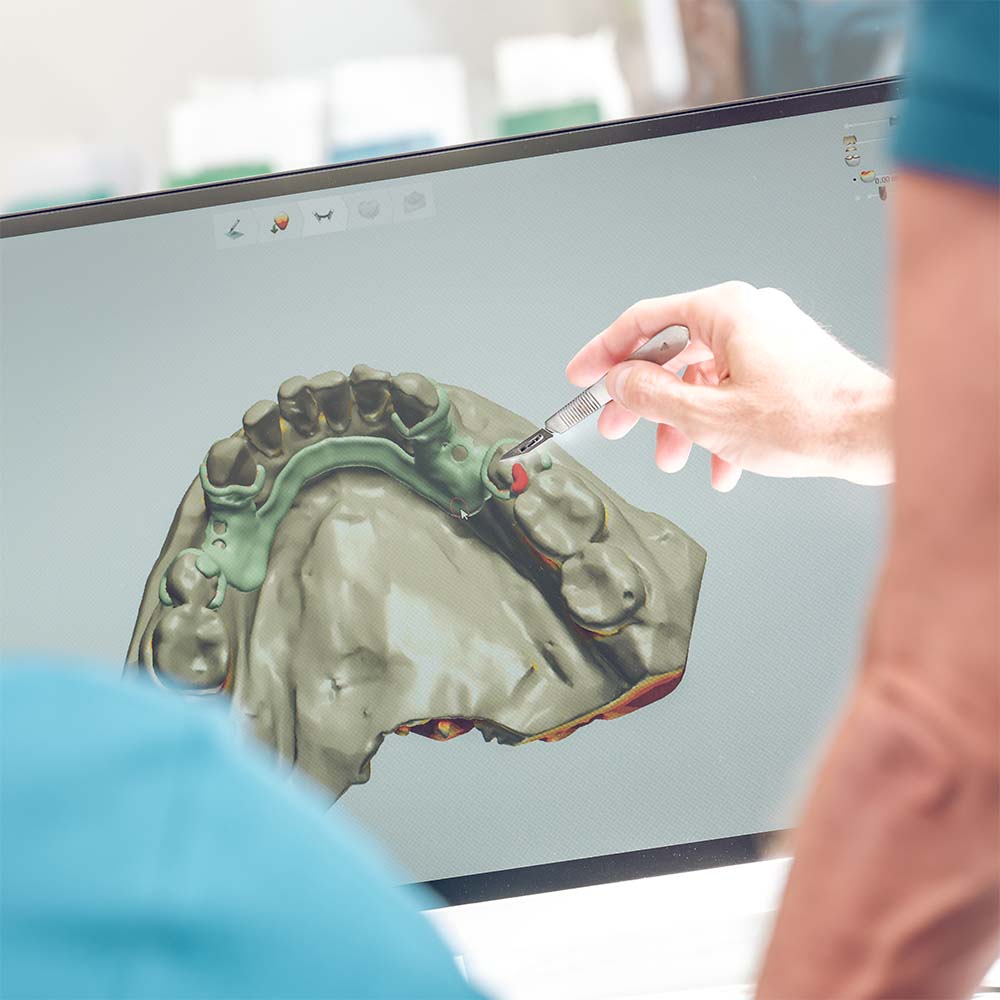 medico dentisto a apontar para ecrã com tomografia 3d da dentadura medico dentisto a apontar para ecrã com tomografia 3d da dentadura