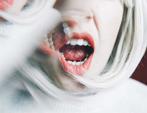 Bruxismo e implantes: como evitar partir, desapertar ou inflamar