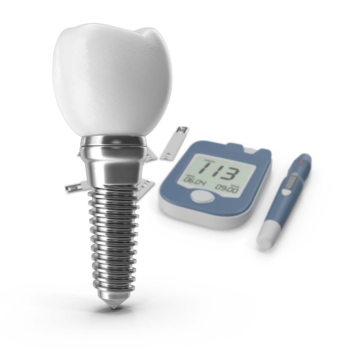 diabetes e implantes o que precisa de estar controlado para ser seguro