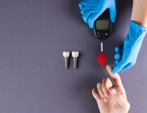 Diabetes e implantes: o que precisa de estar controlado para ser seguro