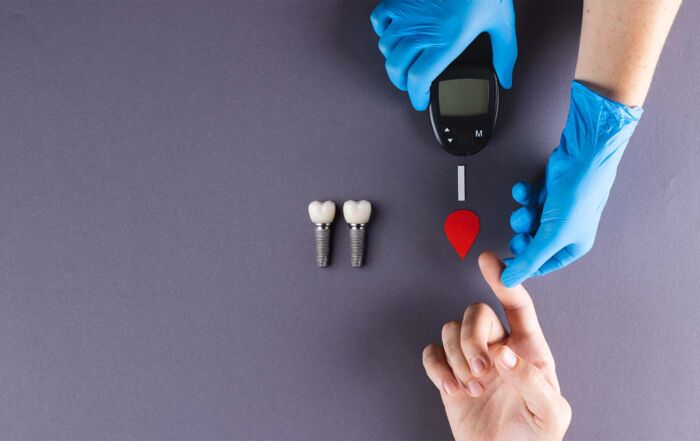 diabetes e implantes dentários