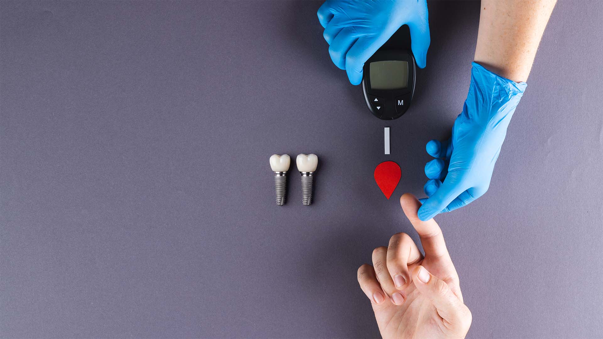 diabetes e implantes dentários
