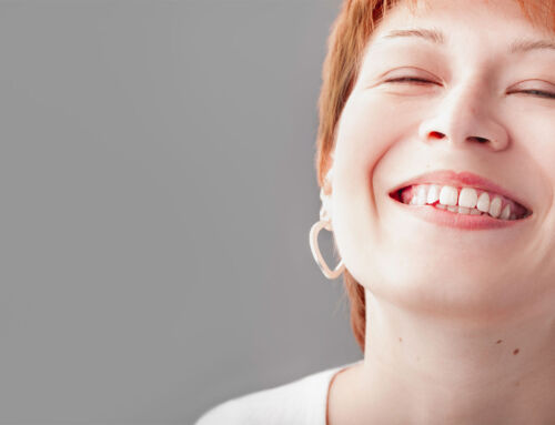 Dentes fixos no próprio dia: quantos implantes vou precisar?