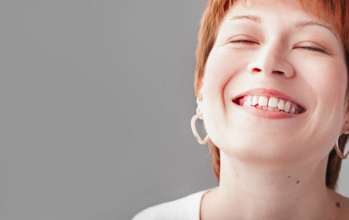 dentes fixos no próprio dia