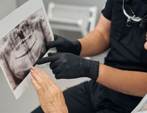 Osteoporose e implantes: quando é seguro avançar