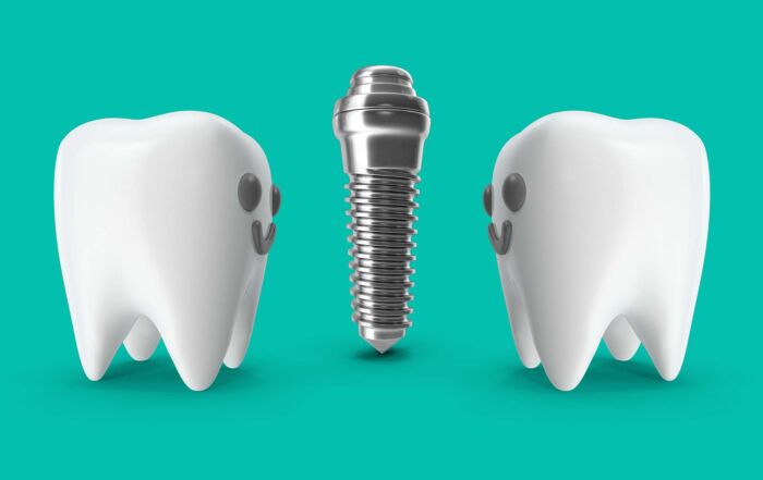 implante unitário ou dois dentes juntos quando “um só” não chega