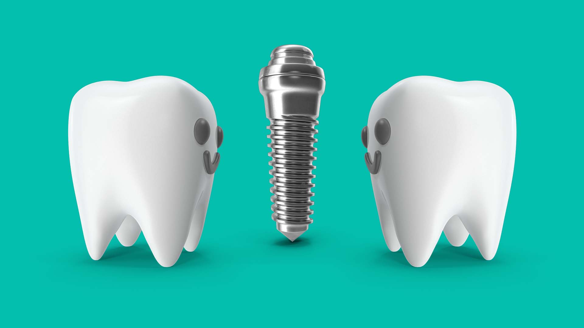 implante unitário ou dois dentes juntos quando “um só” não chega