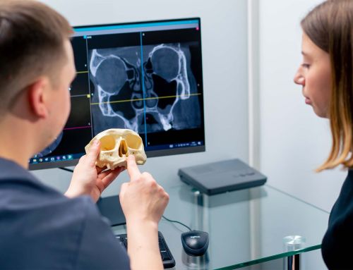 Seio maxilar e implantes: quando é preciso “criar espaço” e quando não