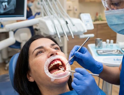 Periodontite e implantes: o que avaliar antes de avançar