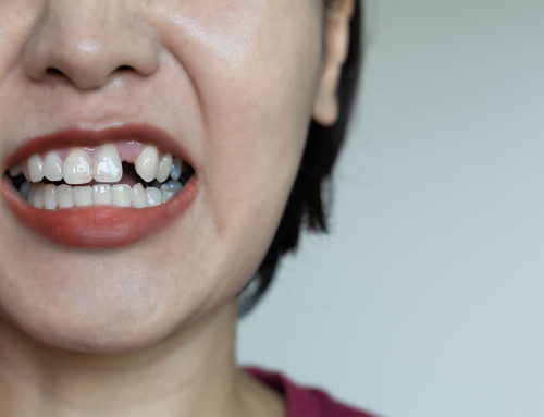 Dente caiu e não dói? Conheça os riscos ocultos da ausência de dor