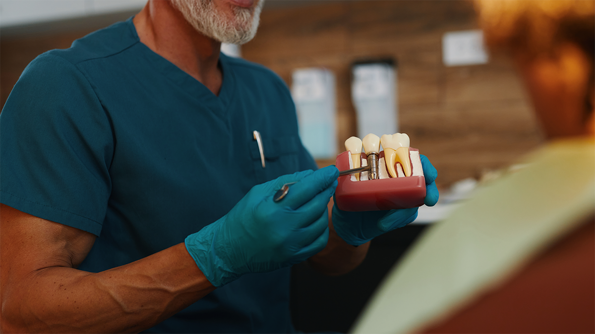 rejeição de implantes dentários mito ou risco real rejeição de implantes dentários mito ou risco real
