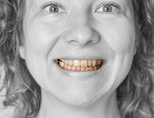 Branqueamento dentário: porque é que os dentes voltam a escurecer e como evitar?