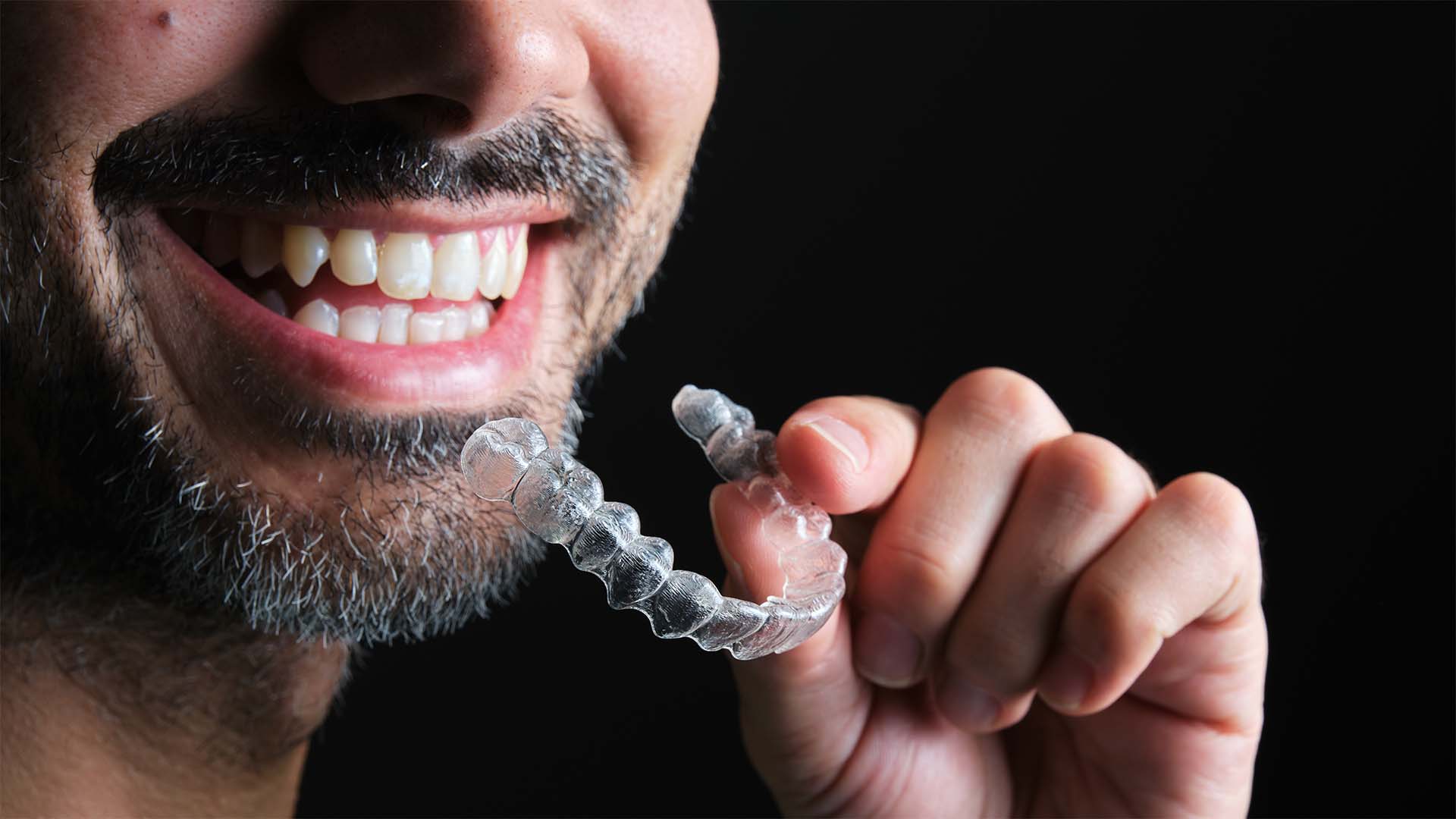 os alinhadores invisíveis podem corrigir dentes desalinhados em adultos. conheça as indicações, limites, duração e importância da contenção os alinhadores invisíveis podem corrigir dentes desalinhados em adultos. conheça as indicações, limites, duração e importância da contenção