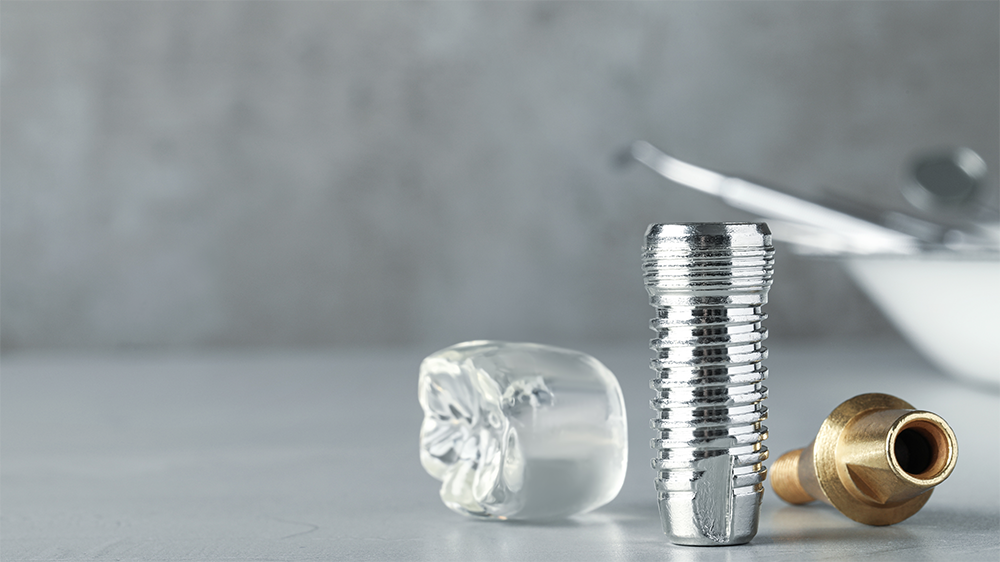 sensibilidade nos dentes vizinhos após um implante sensibilidade nos dentes vizinhos após um implante